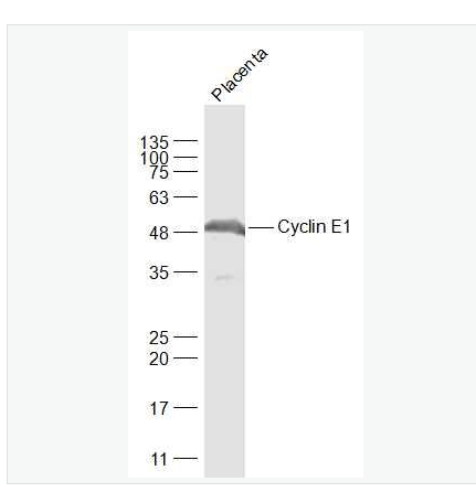 Anti-Cyclin E1 antibody-周期素E抗体,Cyclin E1