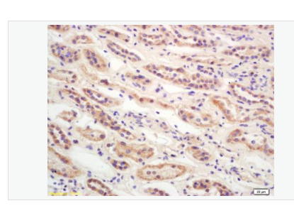 Anti-CDKN2A/p16-INK4a antibody-抑癌基因p16抗体,CDKN2A/p16-INK4a