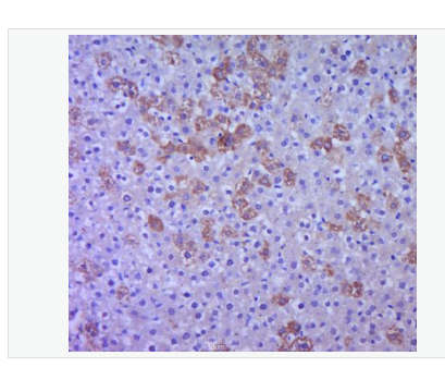 Anti-P38 MAPK antibody-絲裂原活化蛋白激酶p38α抗體,P38 MAPK