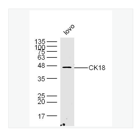 Anti-CK18 antibody-细胞角蛋白18抗体（C端）,CK18