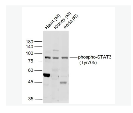 Anti-phospho-STAT3-磷酸化信号转导和转录激活因子3抗体,phospho-STAT3 (Tyr705)