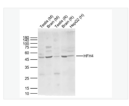 Anti-HFH4 antibody-叉头蛋白J1抗体,HFH4