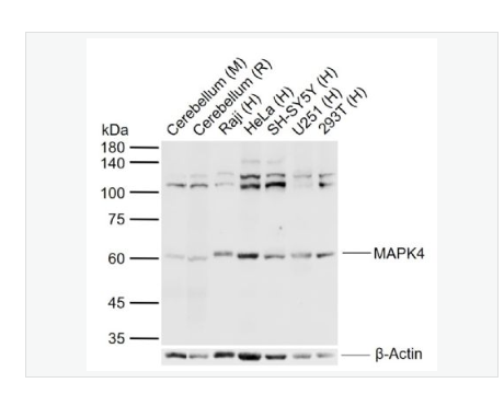 Anti-MAPK4 antibody-细胞外信号调节激酶4抗体,MAPK4