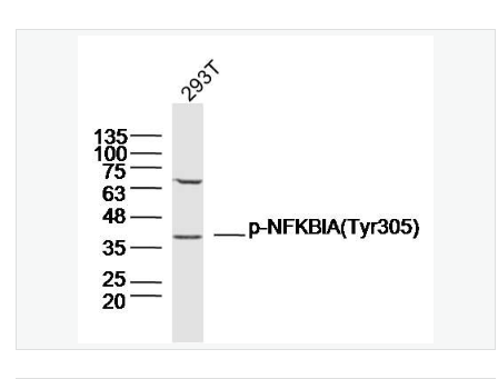 Anti- phospho-IKB alpha -磷酸化IKB alpha抗体,phospho-IKB alpha (Tyr305)