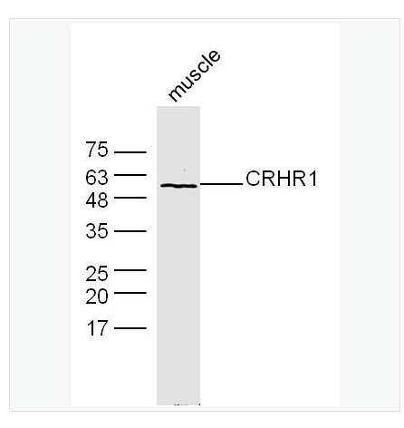Anti-CRHR1 antibody -促肾上腺皮质释放激素受体1抗体,CRHR1