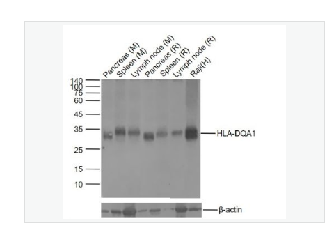 Anti-HLA-DQA1 antibody  -组织相容性抗原DQA1重组兔单克隆抗体,HLA-DQA1