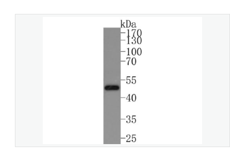 Anti-IKK gamma  antibody  -KB抑制蛋白激酶γ重組兔單克隆抗體,IKK gamma