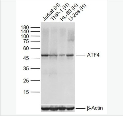 Anti-ATF4 antibody -活化轉(zhuǎn)錄因子4重組兔單克隆抗體,ATF4