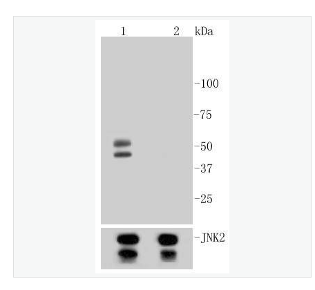 Anti-Phospho-JNK1/2/3 -磷酸化氨基末端激酶1/2/3重组兔单克隆抗体,Phospho-JNK1/2/3(T183+T183+T221)