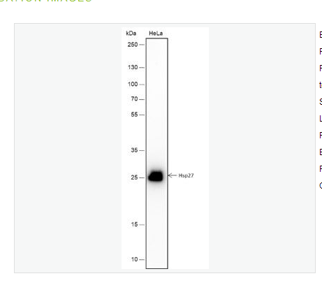 Anti-Hsp27 antibody -熱休克蛋白27重組兔單克隆抗體,Hsp27