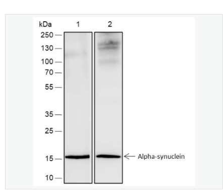 Anti-Alpha Synuclein antibody -核突触蛋白-α（N端）抗体,Alpha Synuclein