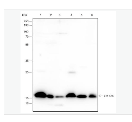 Anti-ARPC5 antibody -肌动蛋白相关蛋白2/3复合体亚基5重组兔单克隆抗体,ARPC5