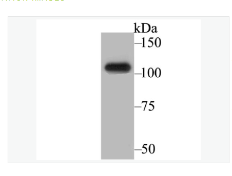 Anti-BRD2 antibody -BRD2蛋白重组兔单克隆抗体,BRD2