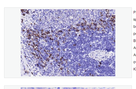 Anti-JCHAIN antibody -J-chain重组兔单克隆抗体,JCHAIN