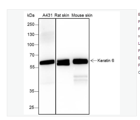 Anti-Keratin 6 antibody -细胞角蛋白6兔单克隆抗体,Keratin 6