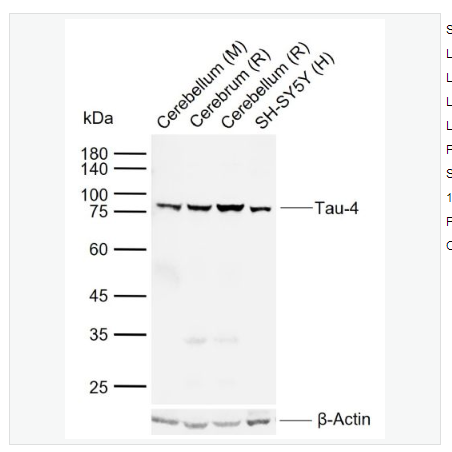 Anti-Tau-4 antibody -人微管相關蛋白Tau-4單克隆抗體,Tau-4