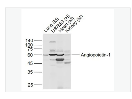 Anti-Angiopoietin-1 antibody -血管生成素-1抗體,Angiopoietin-1