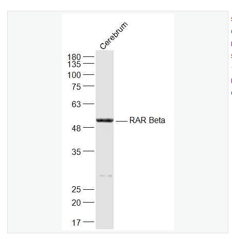 Anti-RARB antibody -维甲酸受体β抗体,RARB