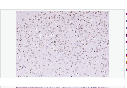 Anti-PEG3 antibody -PEG3蛋白抗體,PEG3