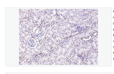 Anti-CENPA antibody-着丝粒蛋白A,CENPA