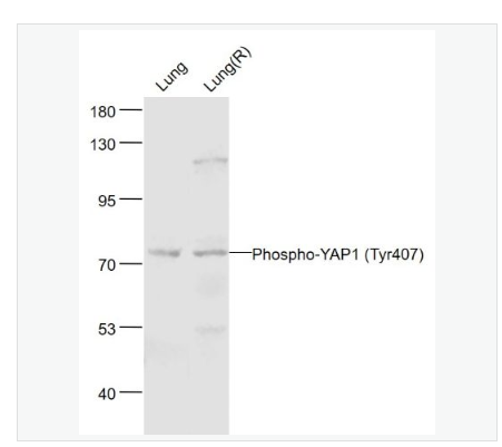 Anti-Phospho-YAP1-磷酸化原癌基因Yes相關(guān)蛋白1抗體,Phospho-YAP1 (Tyr407)