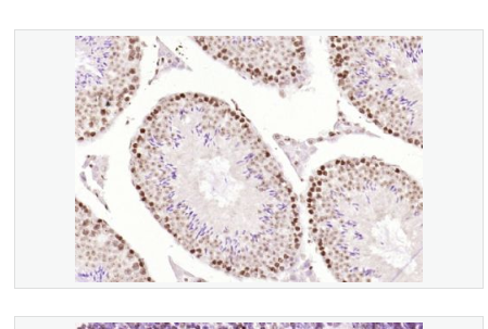 Anti-OGG1 antibody -8-羟基鸟嘌呤DNA糖基化酶,OGG1