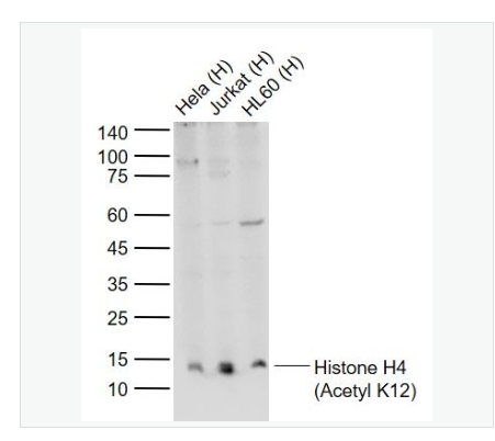Anti-Histone H4 antibody -乙酰化组蛋白H4抗体,Histone H4 (Acetyl K12)