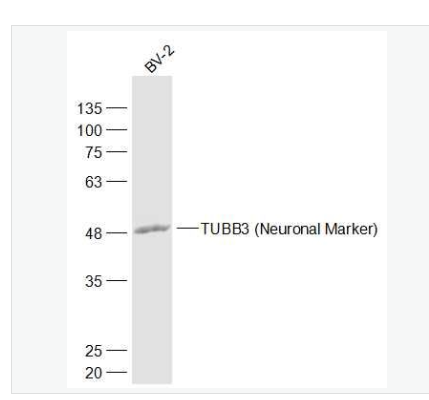 Anti-TUBB3 antibody-神经细胞特异性微管蛋白抗体,TUBB3 (Neuronal Marker)