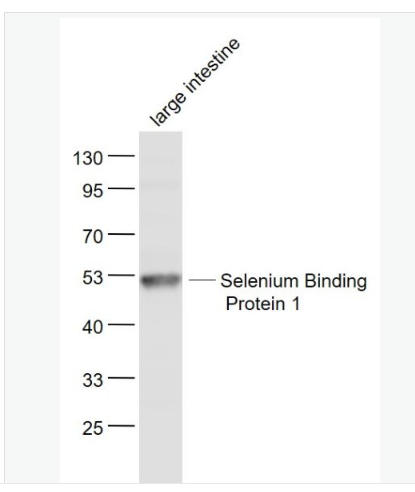 Anti-Selenium Binding Protein 1 antibody-硒结合蛋白1抗体,Selenium Binding Protein 1