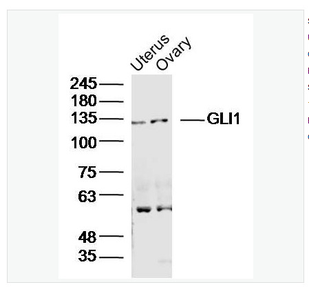 Anti-GLI1 antibody-脑胶质瘤相关蛋白抗体（锌指蛋白5）,GLI1