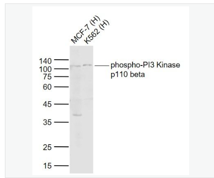 Anti-phospho-PI3-磷酸化磷脂酰肌醇激酶（PI3Kβ）抗体,phospho-PI3 Kinase p110 beta (Ser1070)