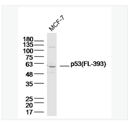 Anti-p53 (FL-393) antibody-肿瘤抑制基因p53抗体,p53 (FL-393)