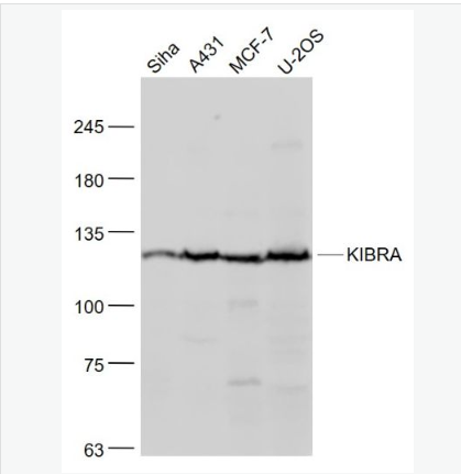Anti-KIBRA antibody-肾脏和脑蛋白抗体,KIBRA