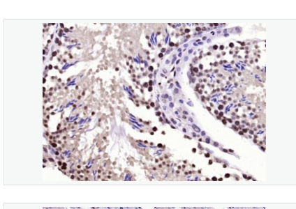 Anti-BPTF antibody-胎兒阿茲海默病抗原/核小體重塑因子抗體,BPTF