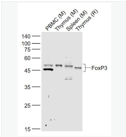 Anti-FOXP3 antibody-叉头蛋白P3抗体,FOXP3