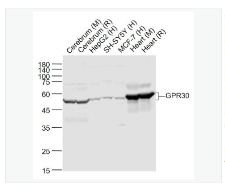 Anti-GPR30 antibody-G蛋白偶聯(lián)受體30抗體,GPR30