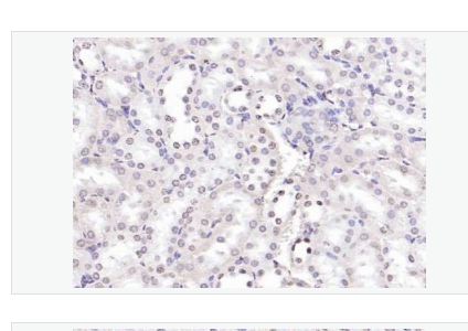 Anti-Beta catenin antibody-β-连环蛋白/β-连环素/β链接素单克隆抗体,Beta catenin