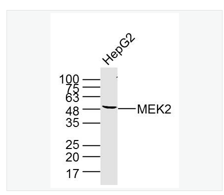 Anti-MEK2 antibody-丝裂原活化蛋白激酶激酶2单克隆抗体,MEK2
