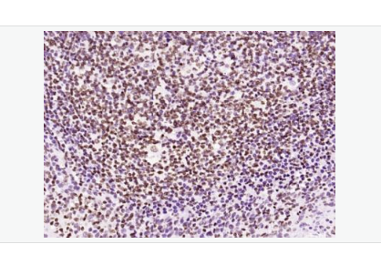 Anti-phospho-JAK2-磷酸化蛋白酪氨酸激酶JAK-2重組兔單克隆抗體,phospho-JAK2 (Tyr1007+Tyr1008)