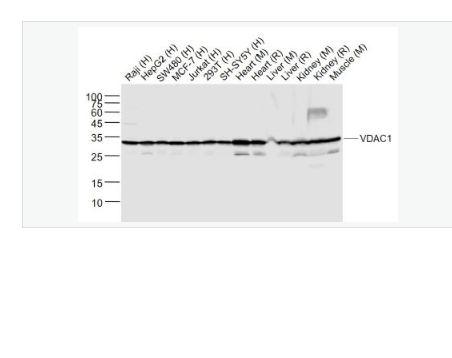 Anti-VDAC1-等电压依赖性阴离子通道（内参）重组兔单克隆抗体,VDAC1(Mitochondrial Loading Control)