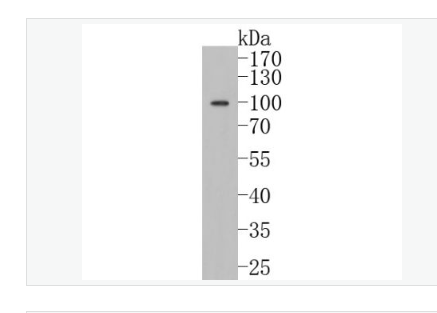 Anti-Calnexin antibody-钙连蛋白重组兔单克隆抗体,Calnexin