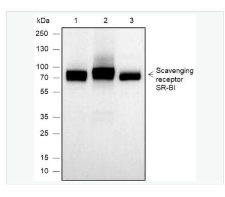 Anti-SCARB1-高密度脂蛋白受体/清道夫受体重组兔单克隆抗体,SCARB1/Scavenger Receptor BI