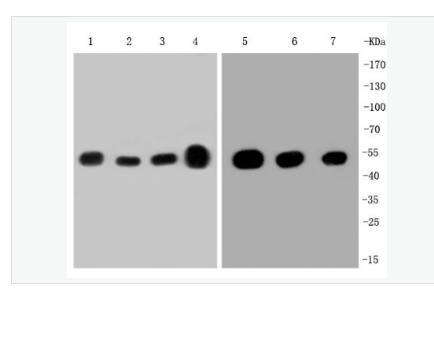 Anti-beta Tubulin  antibody-微管蛋白重組兔單克隆抗體,beta Tubulin