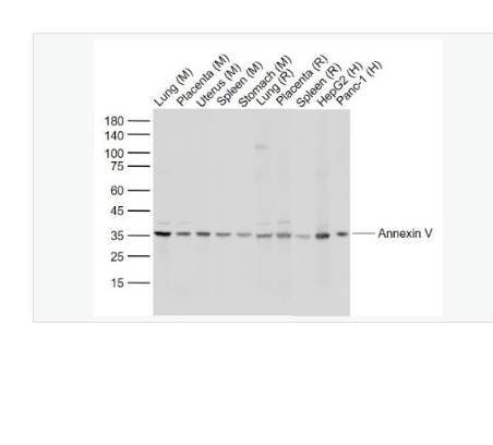 Anti-Annexin V antibody-重组膜粘连蛋白5抗体,Annexin V