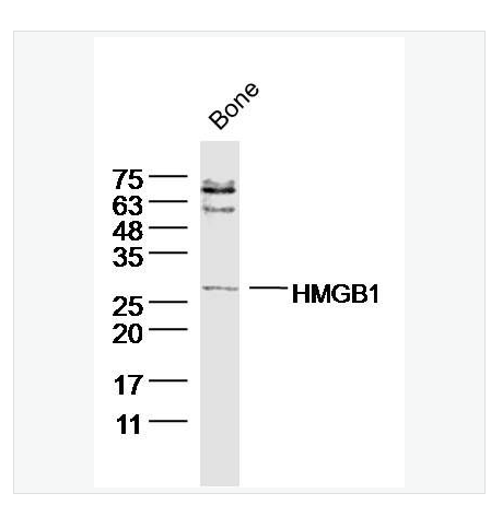 Anti-HMGB1 antibody -高迁移率族蛋白B1抗体,HMGB1
