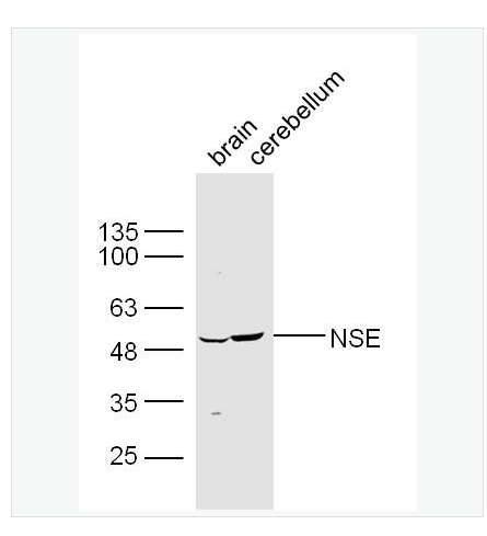 Anti-HMGB1 antibody -神经元特异性烯醇化酶/γ 烯醇化酶抗体,NSE