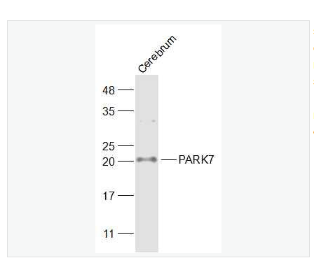 Anti-PARK7/DJ1 antibody -CAP1抗体,PARK7/DJ1