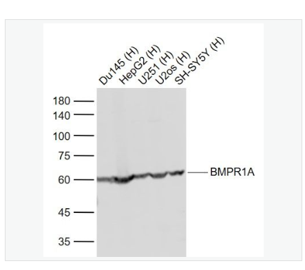 Anti-BMPR1A antibody -骨成型蛋白受体1A抗体,BMPR1A
