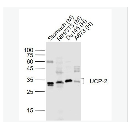 Anti-UCP-2 antibody-線粒體脫偶連蛋白2抗體,UCP-2