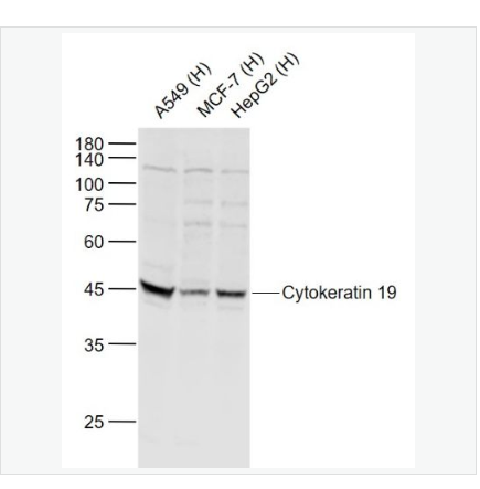 Anti-Cytokeratin 19 antibody-细胞角蛋白19抗体,Cytokeratin 19